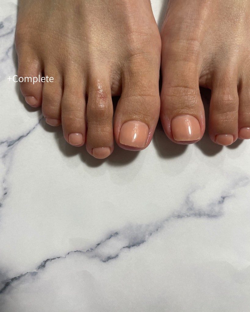 フットワンカラーの施術例